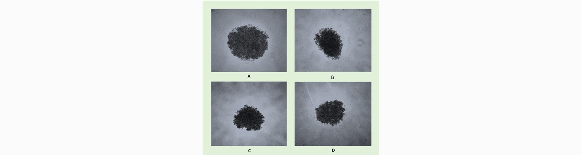 مهار رشد سلولهای سرطان پانکراس AsPC-۱ در کشت سه بعدی توسط ترکیبات مهار کننده گیرنده c-Met
