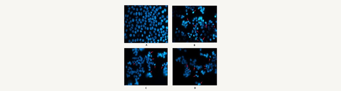 ایجاد آپوپتوز در سلولهای سرطان پستان MCF-۷ توسط ترکیبات مهار کننده گیرنده c-Met
